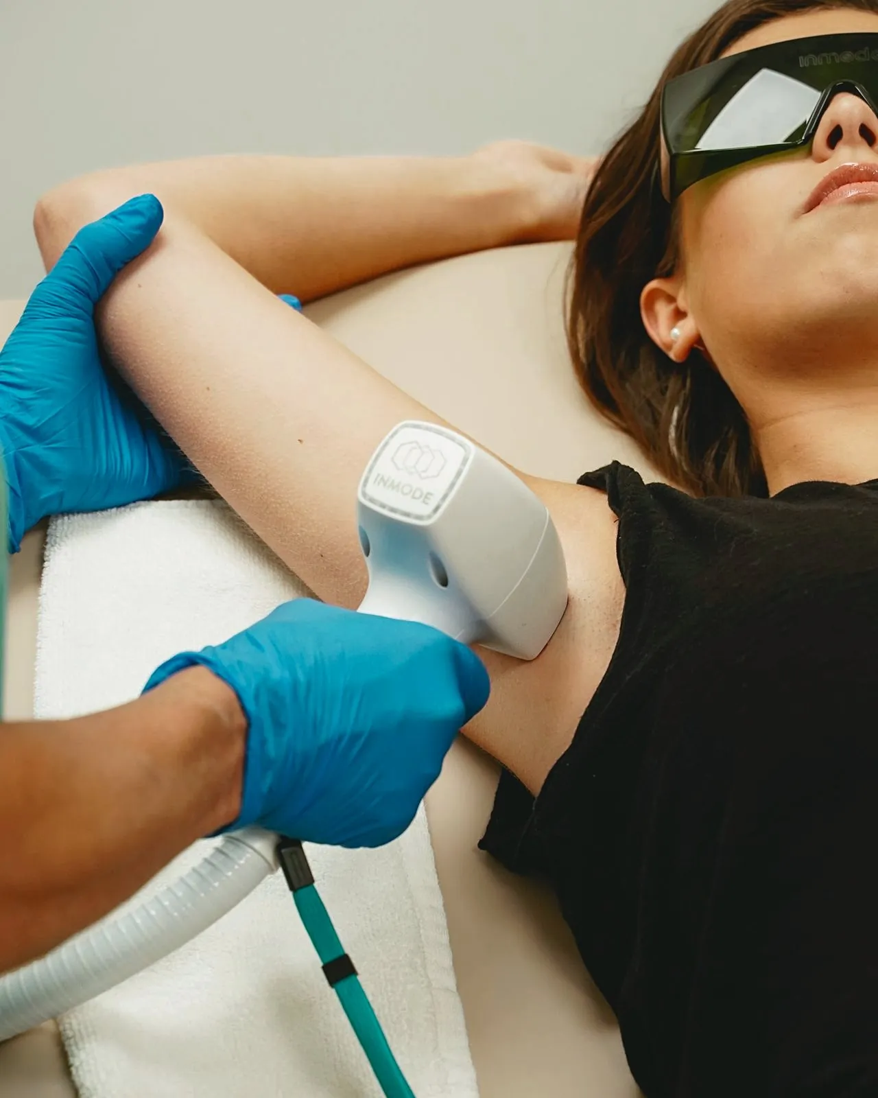 DiolazeXL Laser Hair Removal